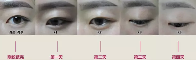 纹绣一周左右颜色变淡了怎么办？